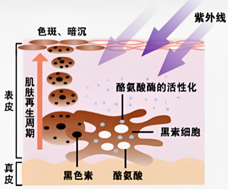 痘痘祛痘_科学祛痘方法,无痘肌肤不是梦!_祛痘科普