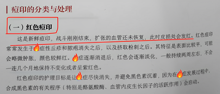 痘痘祛痘_科学祛痘方法,无痘肌肤不是梦!_祛痘科普